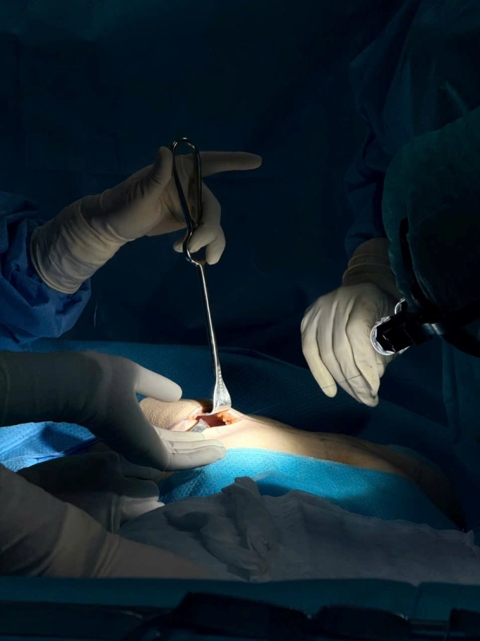 Những gì cần biết về độ cứng c